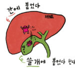 간에 붙었다 쓸개에 붙었다 한다